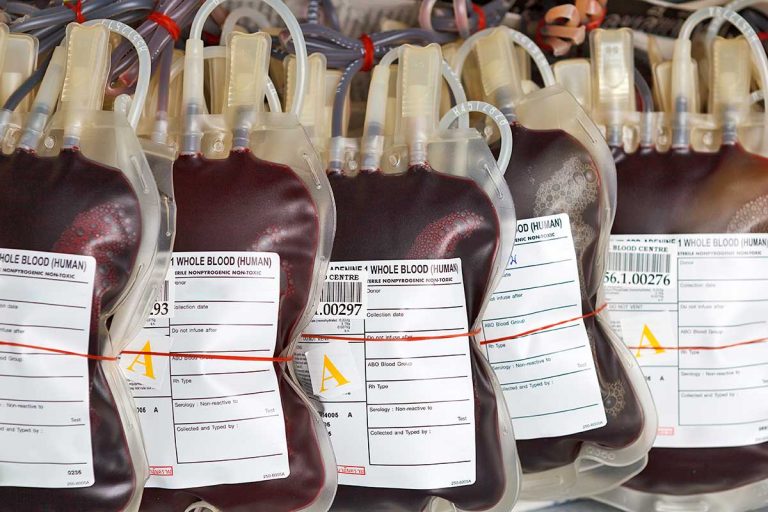 FDA revises guidelines for blood donations from men who have sex with men